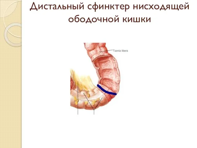 Дистальный сфинктер нисходящей ободочной кишки