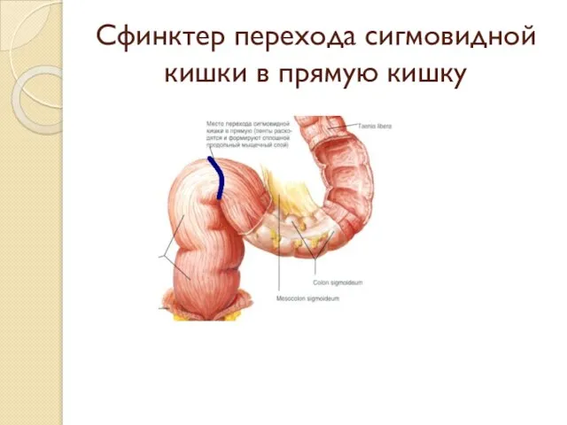 Сфинктер перехода сигмовидной кишки в прямую кишку