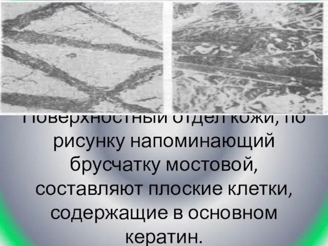 Поверхностный отдел кожи, по рисунку напоминающий брусчатку мостовой, составляют плоские клетки, содержащие в основном кератин. .