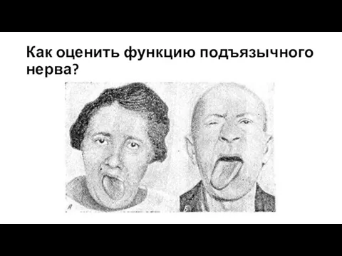 Как оценить функцию подъязычного нерва?