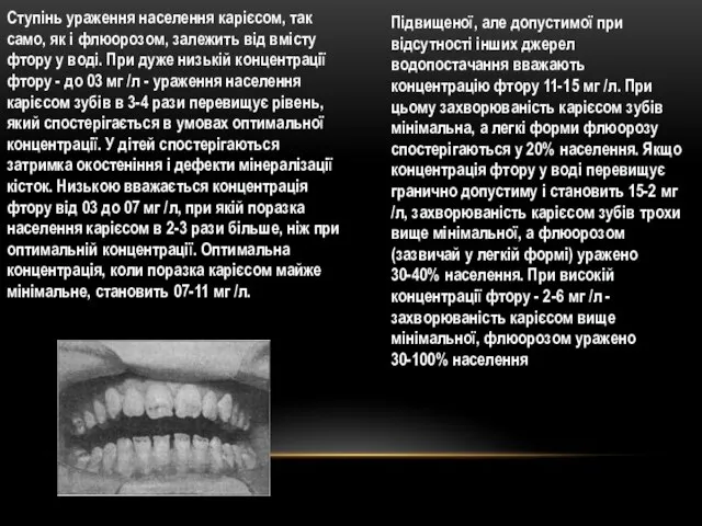 Ступінь ураження населення карієсом, так само, як і флюорозом, залежить від вмісту