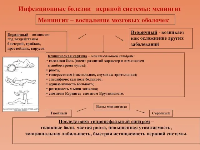 Инфекционные болезни нервной системы: менингит Менингит – воспаление мозговых оболочек Первичный –