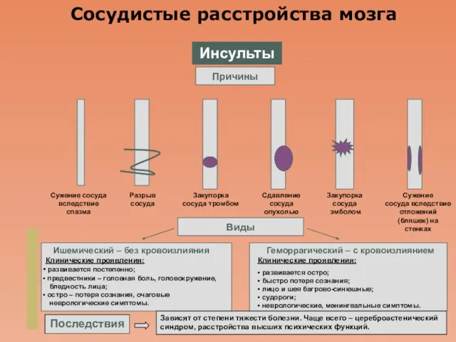 Company Logo Сосудистые расстройства мозга Инсульты Причины Виды Сужение сосуда вследствие спазма