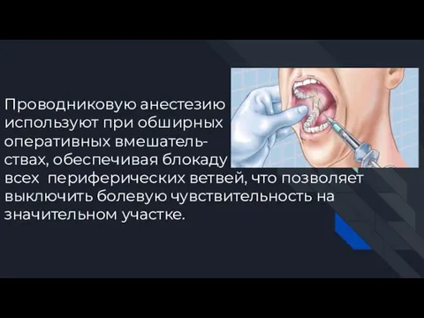 Проводниковую анестезию используют при обширных оперативных вмешатель- ствах, обеспечивая блокаду всех периферических