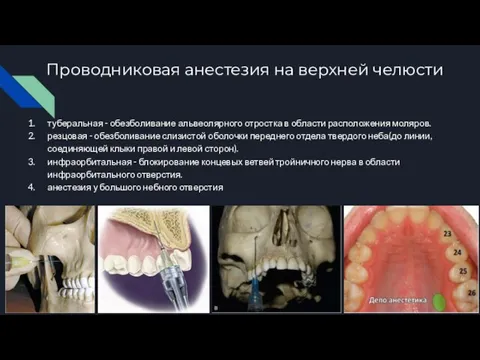 Проводниковая анестезия на верхней челюсти туберальная - обезболивание альвеолярного отростка в области