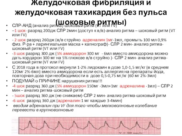 Желудочковая фибриляция и желудочковая тахикардия без пульса (шоковые ритмы) СЛР-АНД (анализ ритма)-шоковый