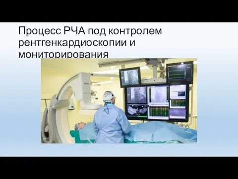 Процесс РЧА под контролем рентгенкардиоскопии и мониторирования