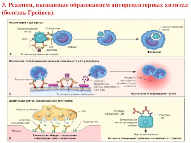 3. Реакции, вызванные образованием антирецепторных антител (болезнь Грейвса).