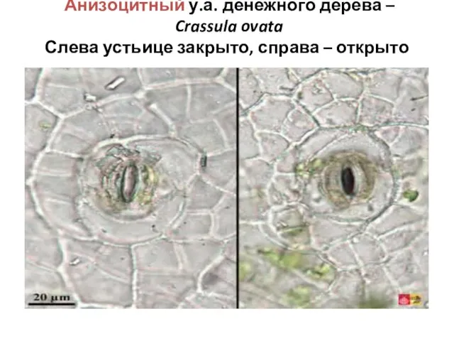 Анизоцитный у.а. денежного дерева – Crassula ovata Слева устьице закрыто, справа – открыто