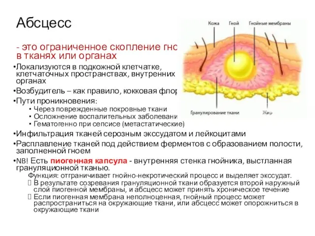 Абсцесс - это ограниченное скопление гноя в тканях или органах Локализуются в