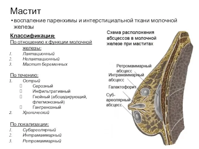 воспаление паренхимы и интерстициальной ткани молочной железы Классификация: По отношению к функции