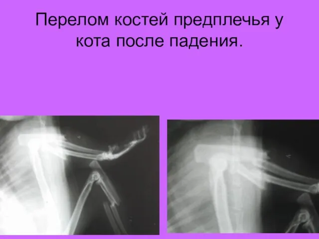 Перелом костей предплечья у кота после падения.