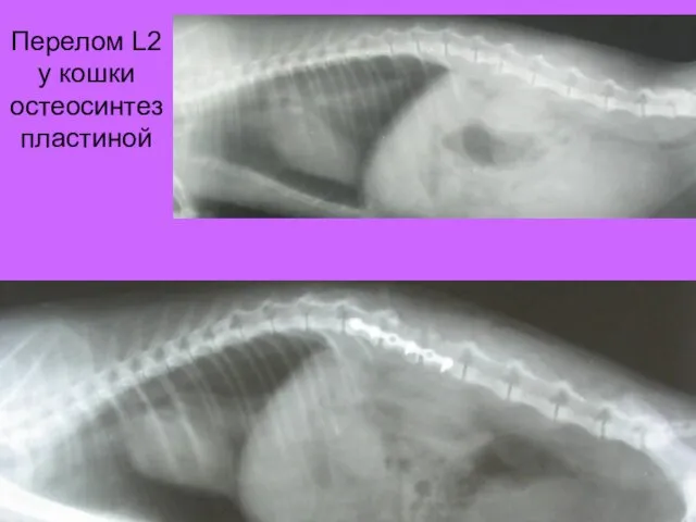 Перелом L2 у кошки остеосинтез пластиной