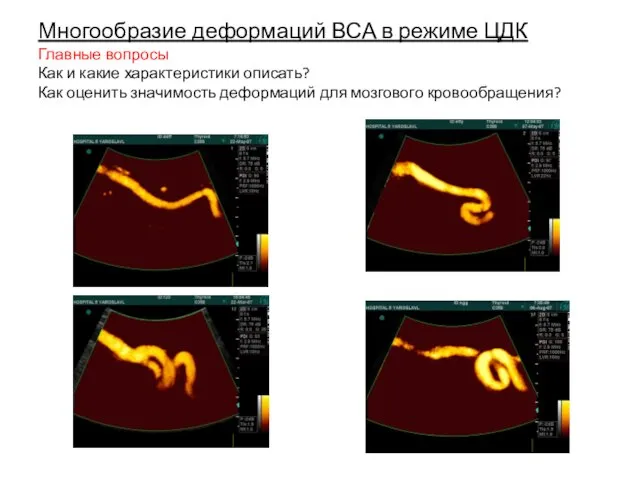 Многообразие деформаций ВСА в режиме ЦДК Главные вопросы Как и какие характеристики