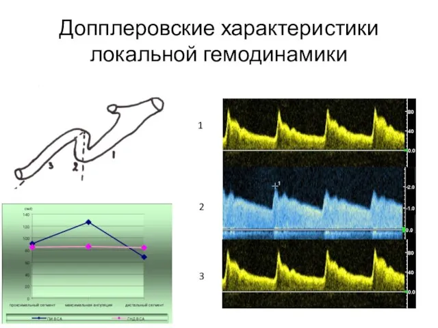 Допплеровские характеристики локальной гемодинамики 1 2 3