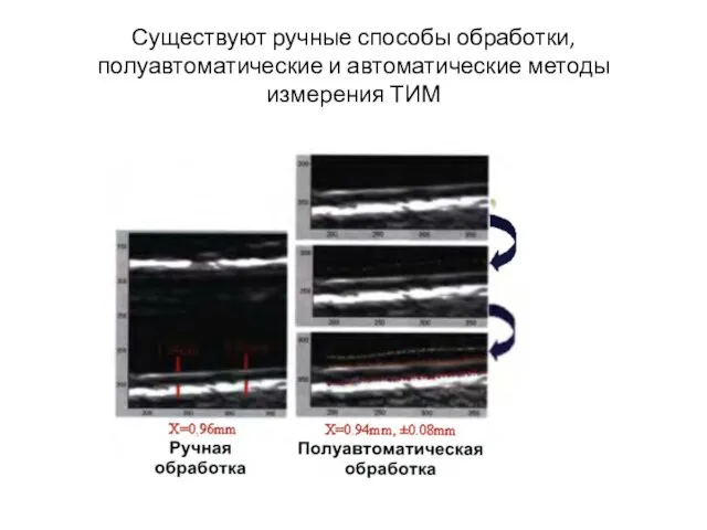 Существуют ручные способы обработки, полуавтоматические и автоматические методы измерения ТИМ