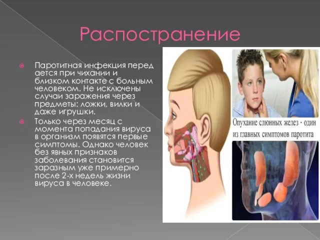 Распостранение Паротитная инфекция передается при чихании и близком контакте с больным человеком.