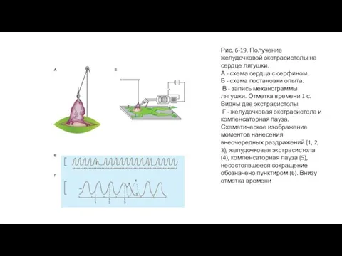 Рис. 6-19. Получение желудочковой экстрасистолы на сердце лягушки. А - схема сердца