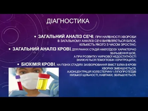 ЗАГАЛЬНИЙ АНАЛІЗ СЕЧІ. ПРИ НАЯВНОСТІ ХВОРОБИ В ЗАГАЛЬНОМУ АНАЛІЗІ СЕЧІ ВИЯВЛЯЄТЬСЯ БІЛОК,