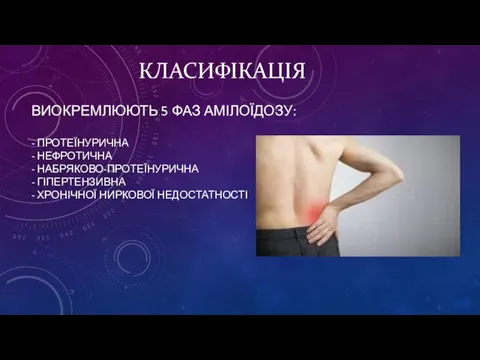 ВИОКРЕМЛЮЮТЬ 5 ФАЗ АМІЛОЇДОЗУ: - ПРОТЕЇНУРИЧНА - НЕФРОТИЧНА - НАБРЯКОВО-ПРОТЕЇНУРИЧНА - ГІПЕРТЕНЗИВНА