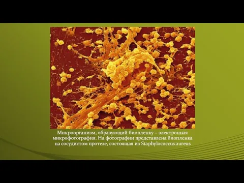 Микроорганизм, образующий биопленку – электронная микрофотография. На фотографии представлена биопленка на сосудистом