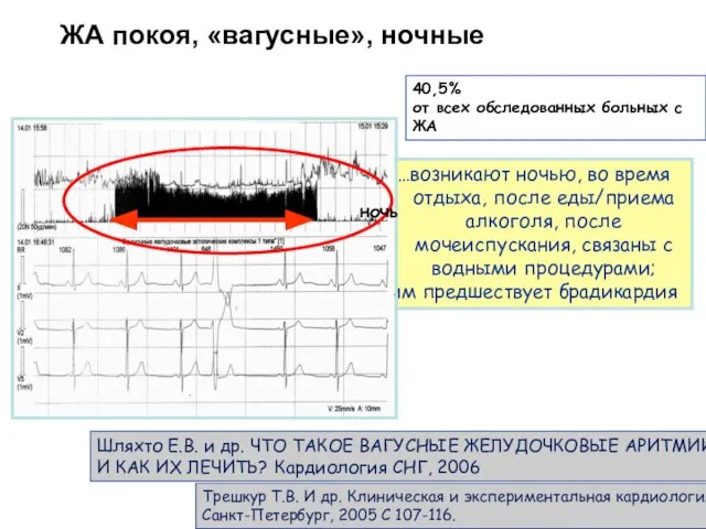 …возникают ночью, во время отдыха, после еды/приема алкоголя, после мочеиспускания, связаны с