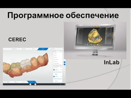 Программное обеспечение CEREC InLab