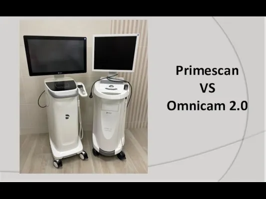 Primescan VS Omnicam 2.0