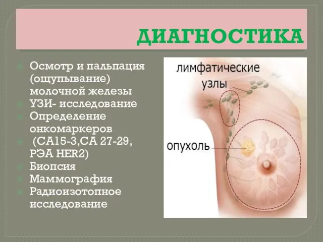 ДИАГНОСТИКА Осмотр и пальпация (ощупывание) молочной железы УЗИ- исследование Определение онкомаркеров (СА15-3,СА