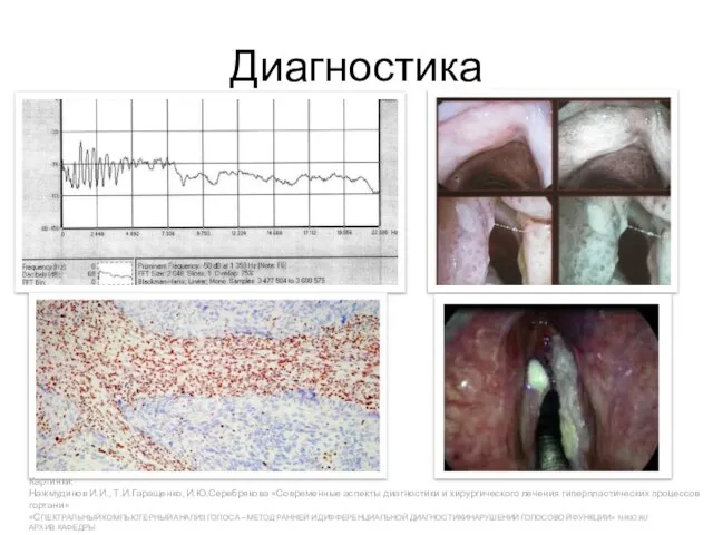 Диагностика Картинки: Нажмудинов И.И., Т.И.Гаращенко, И.Ю.Серебрякова «Современные аспекты диагностики и хирургического лечения