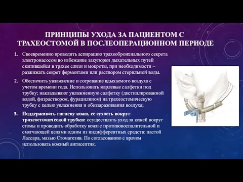 ПРИНЦИПЫ УХОДА ЗА ПАЦИЕНТОМ С ТРАХЕОСТОМОЙ В ПОСЛЕОПЕРАЦИОННОМ ПЕРИОДЕ Своевременно проводить аспирацию