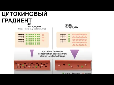 ЦИТОКИНОВЫЙ ГРАДИЕНТ ДО ПРОЦЕДУРЫ ПОСЛЕ ПРОЦЕДУРЫ