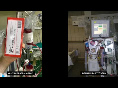 AQUARIUS + CYTOSORB MULTIFILTRATE + ALTECO