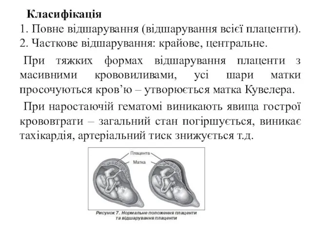 Класифікація 1. Повне відшарування (відшарування всієї плаценти). 2. Часткове відшарування: крайове, центральне.