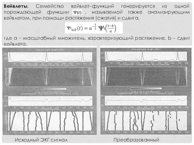 Исходный ЭКГ сигнал Преобразованный Вейвлеты. Семейство вейвлет–функций генерируется из одной порождающей функции