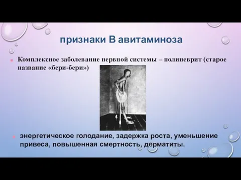 признаки В авитаминоза Комплексное заболевание нервной системы – полиневрит (старое название «бери-бери»)