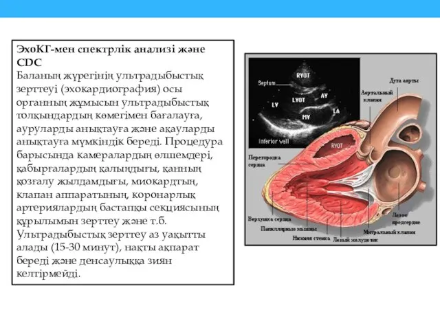 ЭхоКГ-мен спектрлік анализі және CDC Баланың жүрегінің ультрадыбыстық зерттеуі (эхокардиография) осы органның