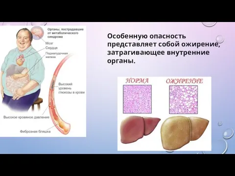 Особенную опасность представляет собой ожирение, затрагивающее внутренние органы.