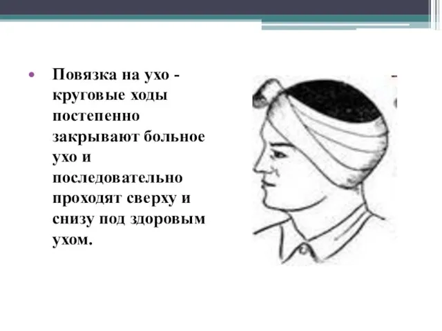 Повязка на ухо - круговые ходы постепенно закрывают больное ухо и последовательно