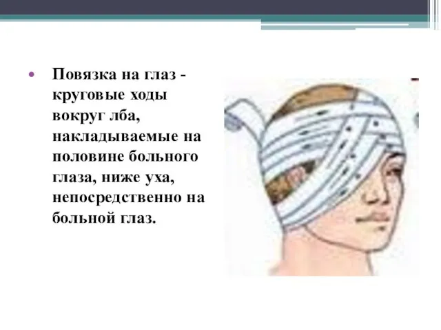 Повязка на глаз - круговые ходы вокруг лба, накладываемые на половине больного