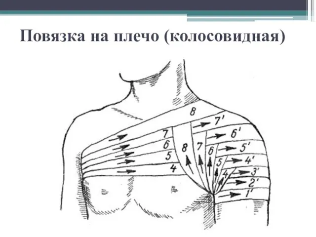 Повязка на плечо (колосовидная)