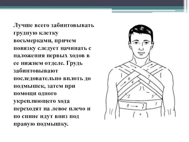 Лучше всего забинтовывать грудную клетку восьмерками, причем повязку следует начинать с наложения