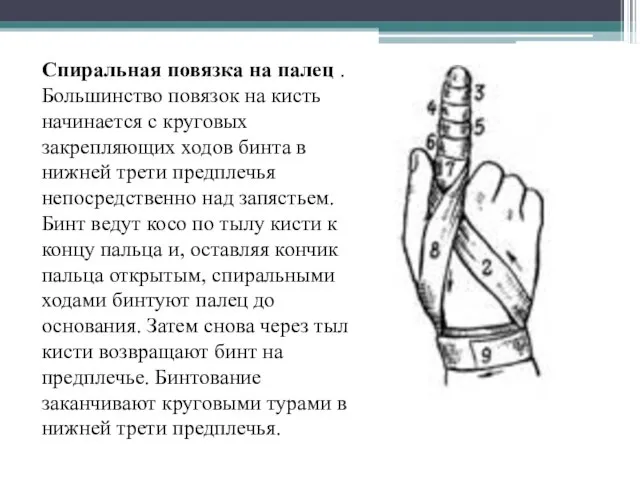 Спиральная повязка на палец . Большинство повязок на кисть начинается с круговых