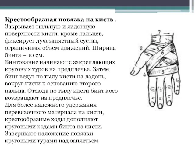 Крестообразная повязка на кисть . Закрывает тыльную и ладонную поверхности кисти, кроме