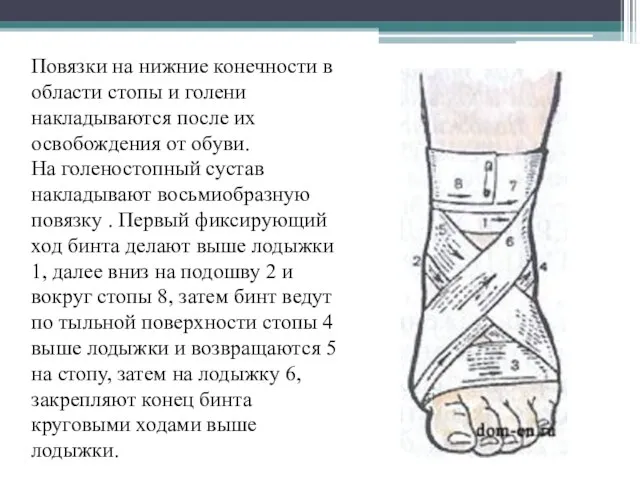 Повязки на нижние конечности в области стопы и голени накладываются после их