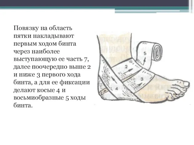 Повязку на область пятки накладывают первым ходом бинта через наиболее выступающую ее