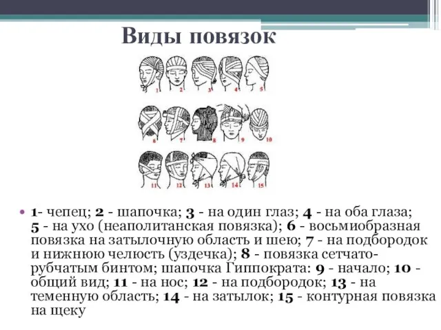 Виды повязок 1- чепец; 2 - шапочка; 3 - на один глаз;