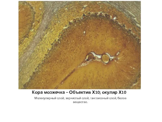 Кора мозжечка – Объектив Х10; окуляр Х10 Молекулярный слой; зернистый слой; ганглиозный слой; белое вещество.