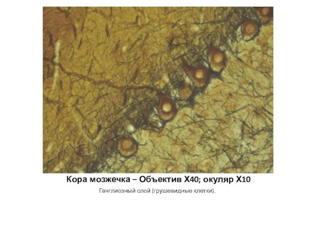 Кора мозжечка – Объектив Х40; окуляр Х10 Ганглиозный слой (грушевидные клетки).