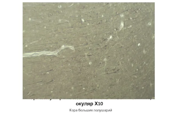 Кора полушарий головного мозга – Объектив Х10; окуляр Х10 Кора больших полушарий